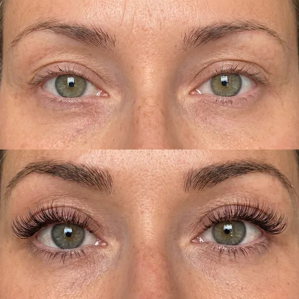 Antes y después, ojos