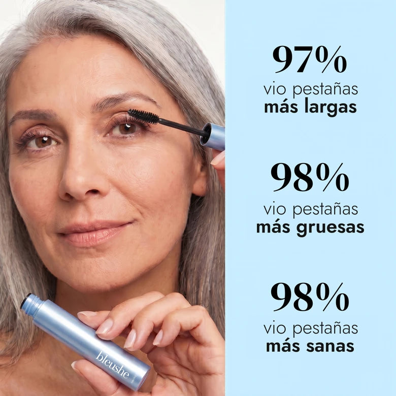 Resultados